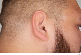 Ronaldo Biggato ear 0002.jpg